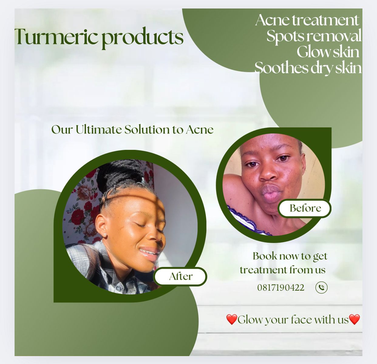 Turmeric by Susan